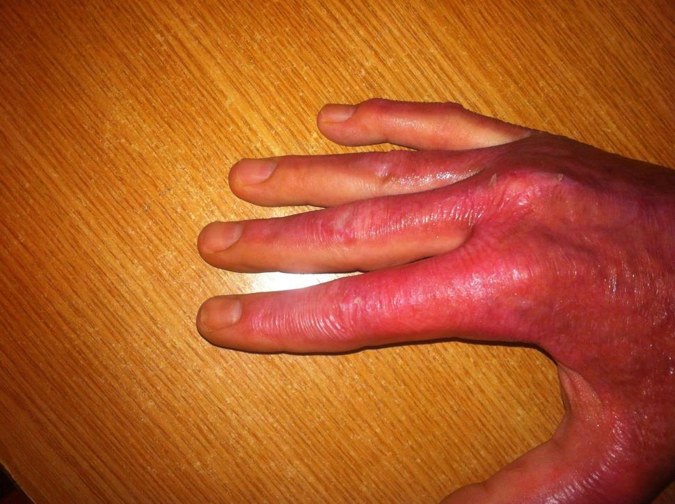  Fotografii cutremurătoare postate de un supraviețuitor din Colectiv. Dorințe pentru 2016. "Durerea este insuportabilă" 352647