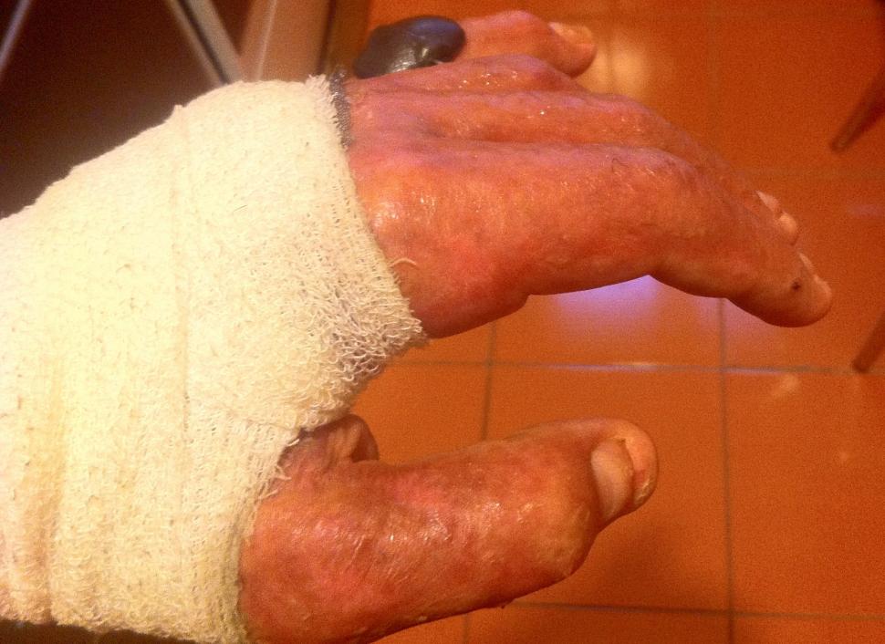  Fotografii cutremurătoare postate de un supraviețuitor din Colectiv. Dorințe pentru 2016. "Durerea este insuportabilă" 352648