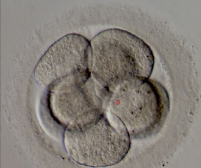 Fără precedent: Cercetătorii britanici au primit dreptul de a modifica genetic embrioni umani