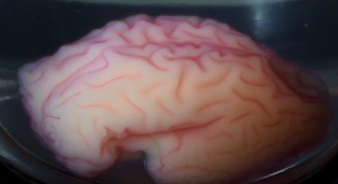 Oamenii de ştiinţă au „imprimat” un creier 3D și au făcut descoperiri fascinante. VIDEO