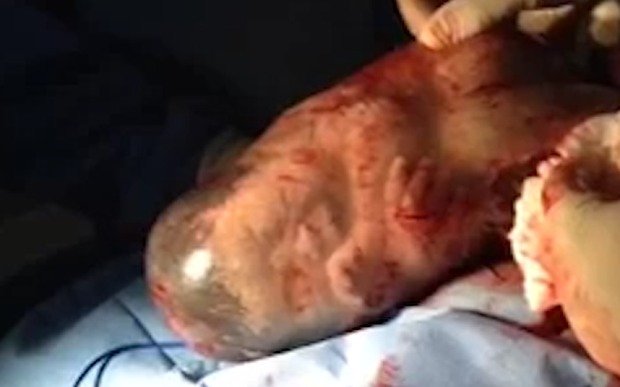 Imagini impresionante. Momentul în care un bebeluș este eliberat din sacul amniotic și respiră pentru prima oară