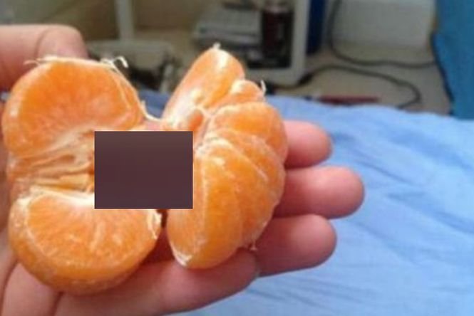 A decojit o portocală și a făcut o descoperire uluitoare. Imaginea a devenit virală pe internet