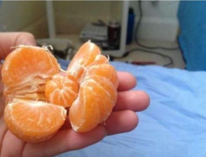 A decojit o portocală și a făcut o descoperire uluitoare. Imaginea a devenit virală pe internet 371702