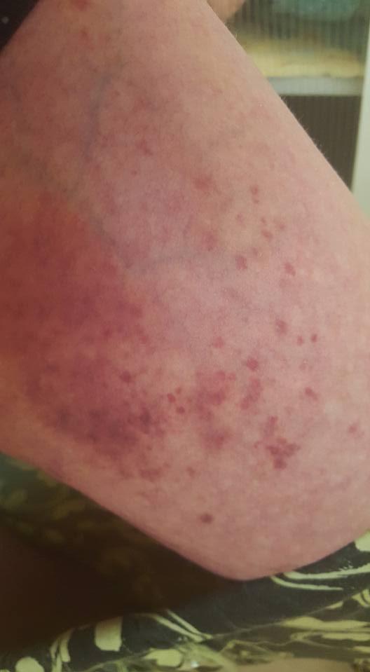 Imagini şocante! Fotografiile postate pe Facebook de o femeie, după ce a fost violată de un bărbat pe care l-a cunoscut pe internet 375825