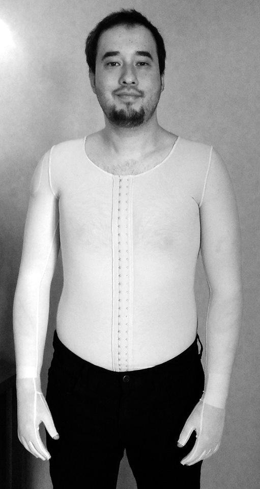 Supraviețuitor din Colectiv, despre spitalele din România: Este genocid ceea ce se întâmplă acolo! 379920