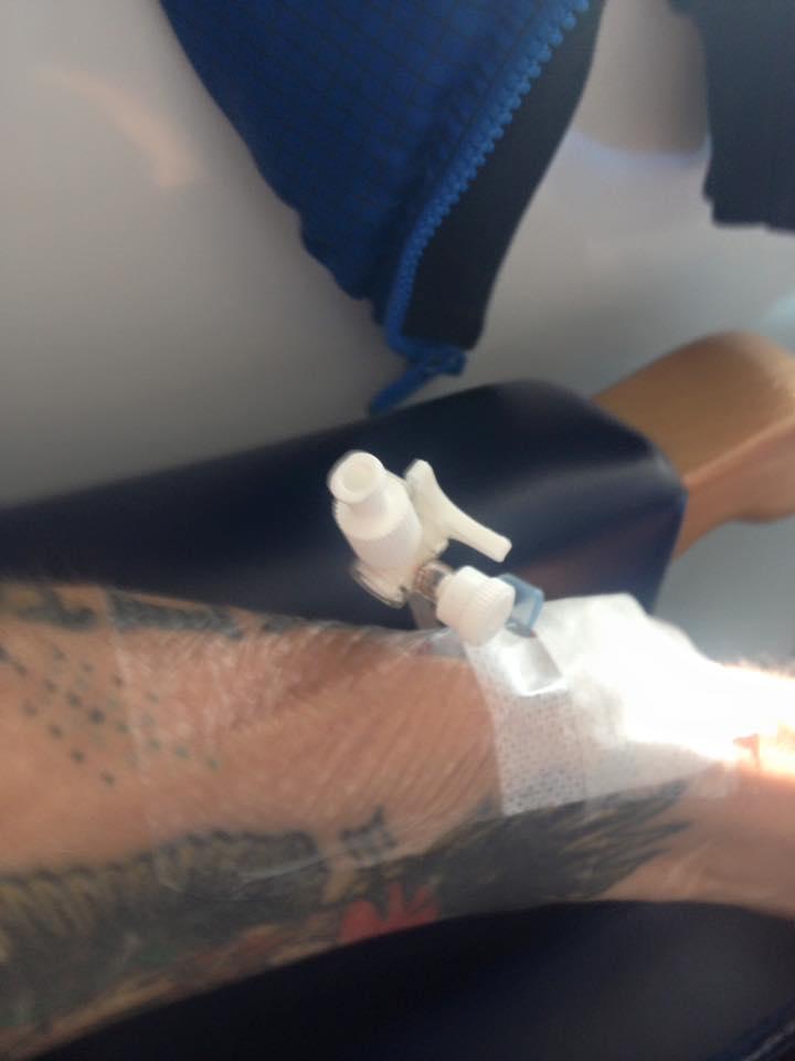 Asta ți se poate întâmpla dacă fumezi. Fotografia șocantă publicată de un fumător de pe patul de spital 381777