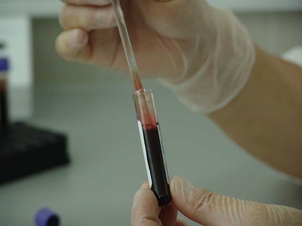 Țara în care mii de oameni au fost contaminați cu virusul HIV prin transfuzii sanguine 