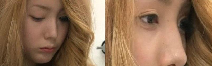 Nu s-a demachiat deloc doi ani. Dupa ce a facut-o in sfarsit si s-a uitat in oglinda a avut un soc! Uite cum arata pielea ei 385064