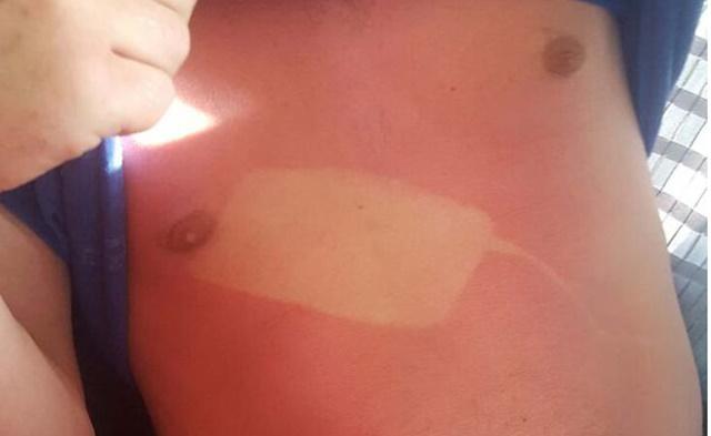 A adormit cu telefonul pe piept in timp ce statea pe plaja! Ce s-a intamplat cu barbatul dupa: “Toata lumea se uita si…” 391394