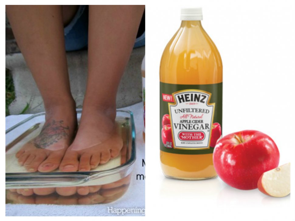 VIDEO! Femeia asta si-a inmuiat picioarele in otet de mere in fiecare zi, timp de o luna! Afla de ce si ce i s-a intamplat apoi