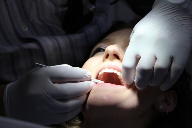 De ce nu este bine să ne albim dinții. Secretul dezvăluit de un stomatolog