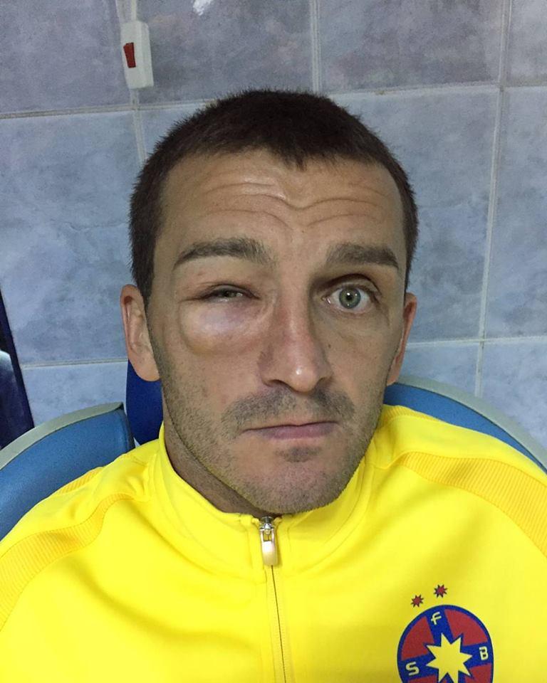 Cum arată un jucător al Stelei după dezastrul în fața lui Manchester City. FOTO 400273