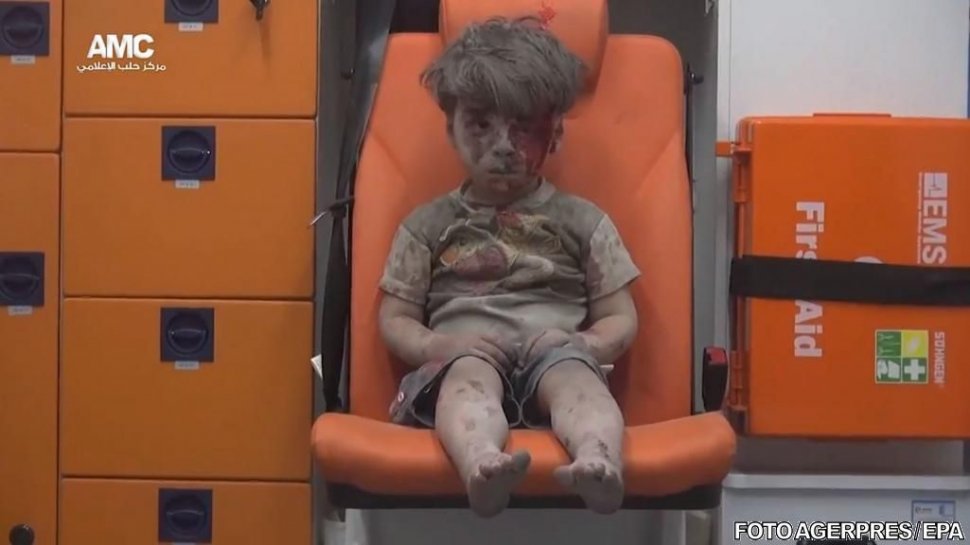 &quot;O fotografie cât 1000 de cuvinte&quot;. O nouă imagine cu ”băieţelul din ambulanță” face înconjurul lumii