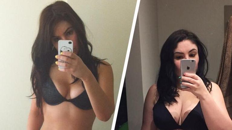 A postat pe Facebook o fotografie de dinainte de sarcină și una după ce a născut. Cum arată în realitate corpul unei mame 403550