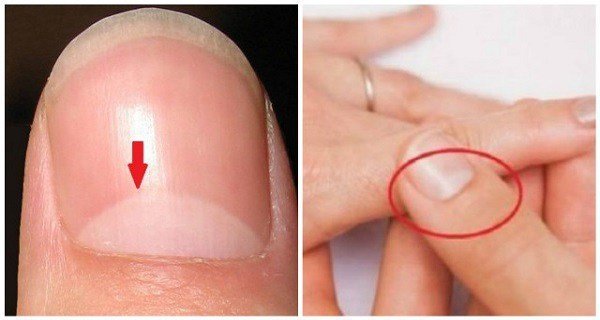 Stii ce inseamna semiluna de pe unghiile tale? Raspunsul este mai important decat crezi!