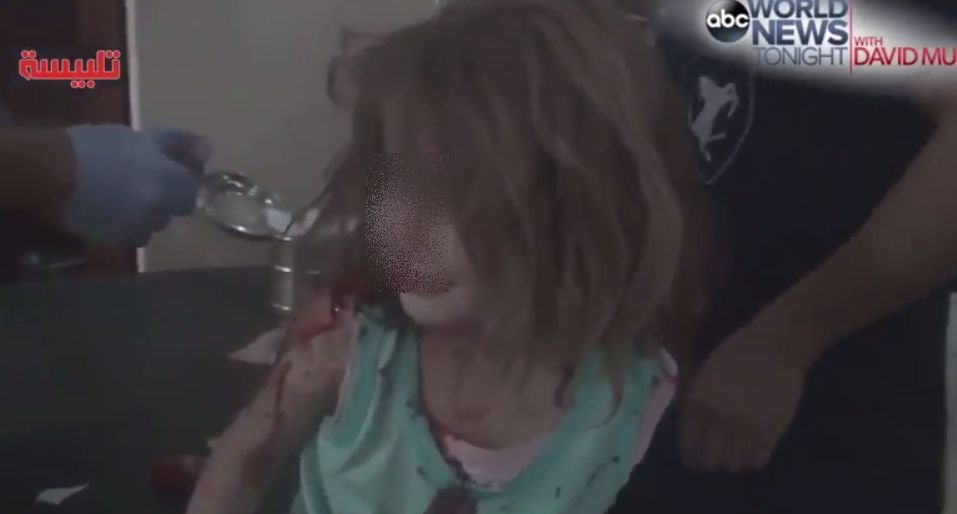 &quot;Acoperişul a căzut pe mine!&quot;. Imaginile cu o fetiță din Siria care își strigă tatăl, printre suspine, fac înconjurul lumii