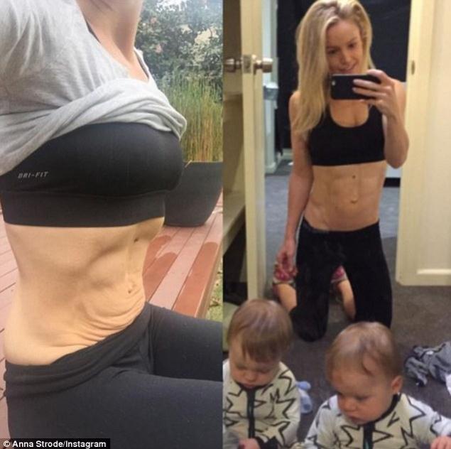 Cum arata abdomenul femeii la doua luni dupa ce a nascut gemeni! Pare perfect, dar daca te uiti cu atentie... 410943