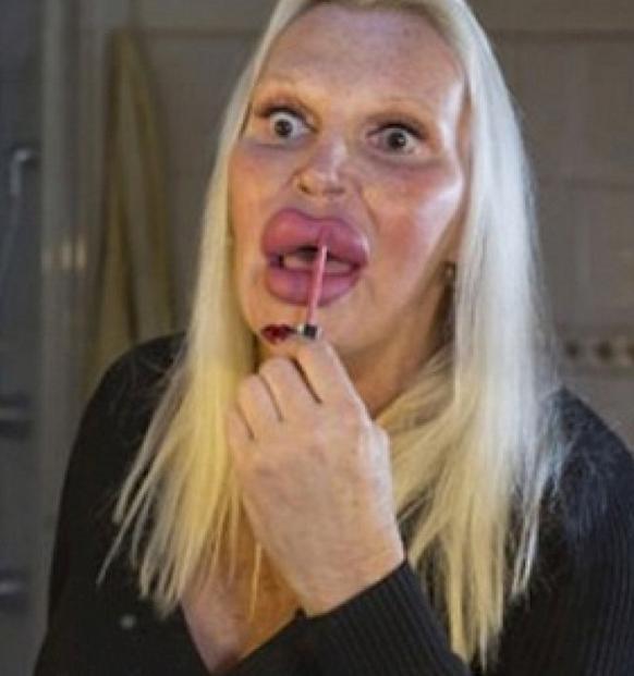 A cheltuit o avere ca să arate perfect, dar și-a distrus fața. Iată cum arată (Foto) 411880