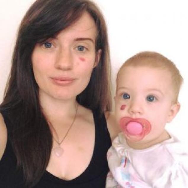 Iesea mereu din casa cu un semn facut cu rujul sub ochi. Toti cunoscutii se uitau ciudat la ea! Motivul uluitor pentru care recurgea la acest gest 411918