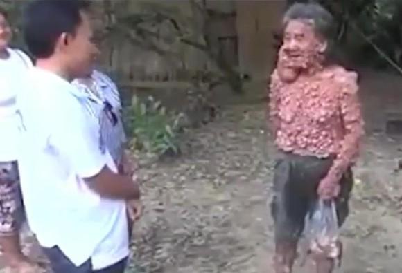 De 45 de ani nu a mai ieşit din casă, de teamă să nu sperie lumea. Cum arată bărbatul (Foto) 417431