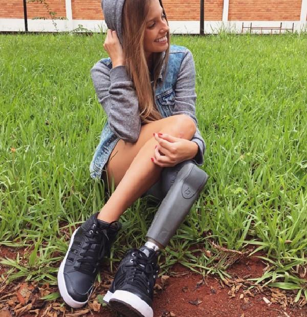 Povestea cutremurătoare din spatele acestui zâmbet. Cum arată această fată de la brâu în jos - FOTO  417875