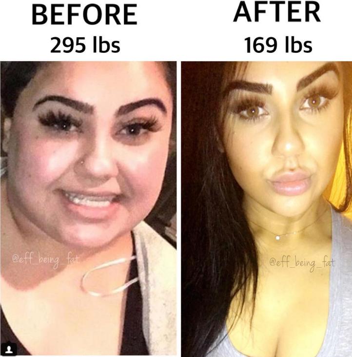 Era atat de grasa incat propriul tata i-a spus ca ii este rusine sa mai mearga cu ea pe strada si ca seamana cu un pui de elefant  418594