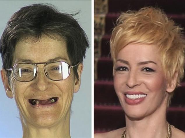 Se temea că va fi părăsit de soț, dar acum e de nerecunoscut! Cum arată Ligia, la șase ani de la transformarea suferită în cadrul unei emisiuni TV 423715