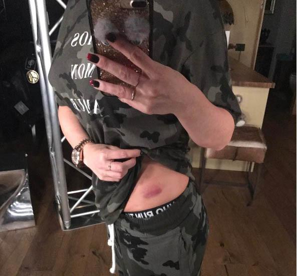 Delia, accident pe scenă înainte de show-urile de la Sala Palatului. A căzut şi… 435498