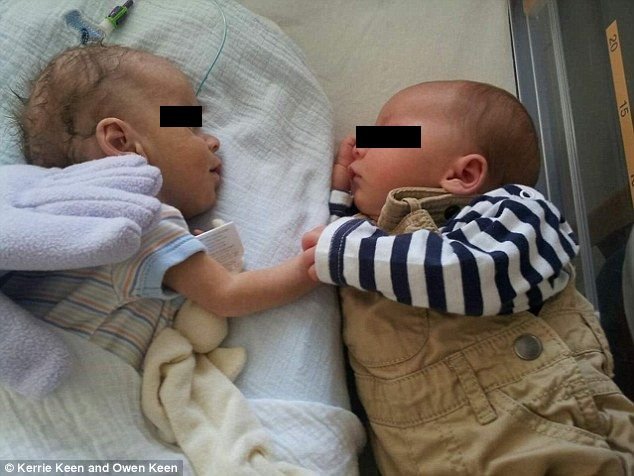 Povestea incredibilă din spatele fotografiei în care doi bebeluși se țin de mână, într-un incubator de spital
