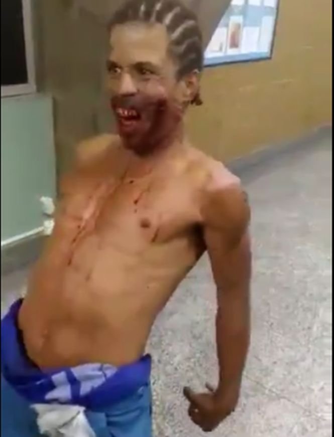 Un bărbat împușcat în față a speriat un spital întreg. Medicii au crezut că era „posedat” - VIDEO șocant