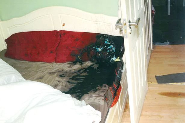 Un român din Anglia a fost atacat cu acid de iubita lui britanică, în timp ce dormea. Tânărul a orbit 