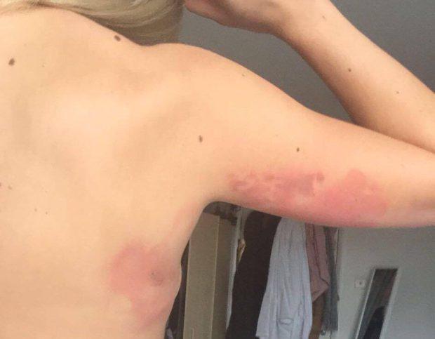 Toată lumea le lăuda pentru frumusețea lor. Surorile au ieșit în club de Paște și au ieșit de acolo desfigurate. Poze șocante - FOTO 445242