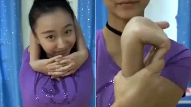 Ea este femeia care își poate răsuci mâna la 720 de grade - VIDEO