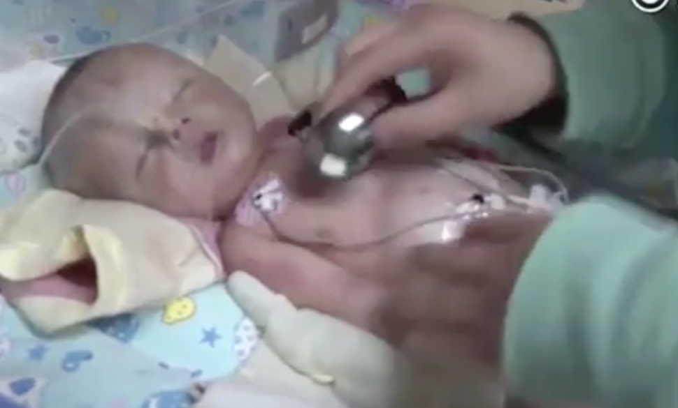Un nou-nascut a fost ingropat de viu si a fost salvat in ultima clipa! Medicii s-au ingrozit: &quot;Avea gura plina de pamant&quot; 
