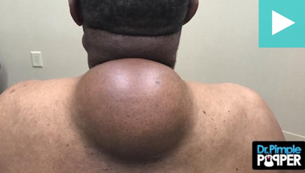 Ce reprezinta aceasta imagine? Ai zice ca este o gravida, dar nu… 451120