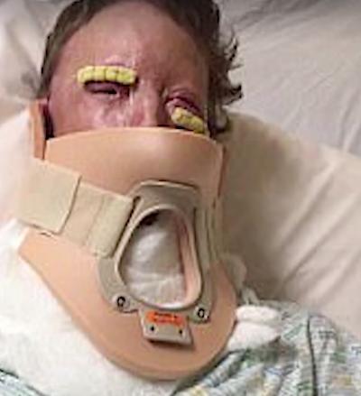 Avea un soț extraordinar și o fetiță minunată. Într-o zi a făcut un grătar și i-a ars toată fața - Bărbatul ei a dovedit ce multe femei credeau 451466