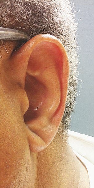 Ai semnul acesta pe lobul urechii? Trebuie să vezi imediat un medic. Viața ta depinde de asta