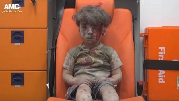Cum arată acum Omran, copilul care a devenit simbolul suferințelor din Siria - FOTO