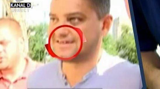 Stomatologul lui Boureanu face dezvaluiri! Cum arata dintii fostului politician: “Cand am vazut cat e de grav…” 457182