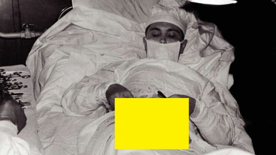 Povestea doctorului Leonid Rogozov, chirurgul rus care s-a operat singur de apendicită