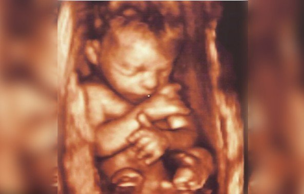 Mama însărcinată a vrut să filmeze prima ei ecografie, dar când medicul a văzut ce are în ea i-a spus disperat: &quot;Nu vrei să ai amintire cu așa ceva!&quot; Ce apărea în ecografia femeii