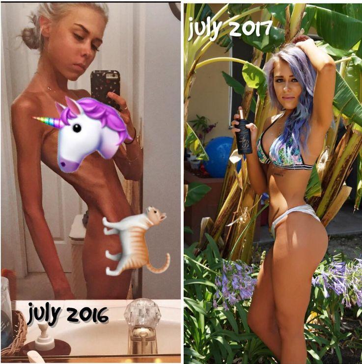 Este superbă, dar nu a arătat mereu așa! „Am fost la câteva ore de moarte”. Nu o să îți vină să crezi când vei vedea imaginile! 470706