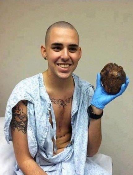 Și-a ținut inima în mână! Adevărul şocant din spatele acestei imagini 472624