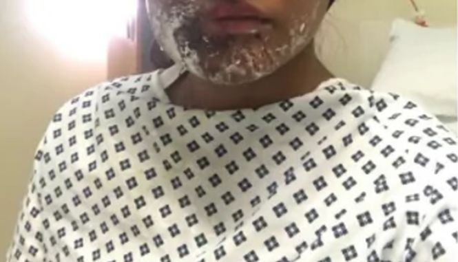 A fost atacată cu acid și desfigurată în ziua în care împlinea 21 de ani. „Medicii au făcut o minune!” Cum arată acum tânăra - FOTO