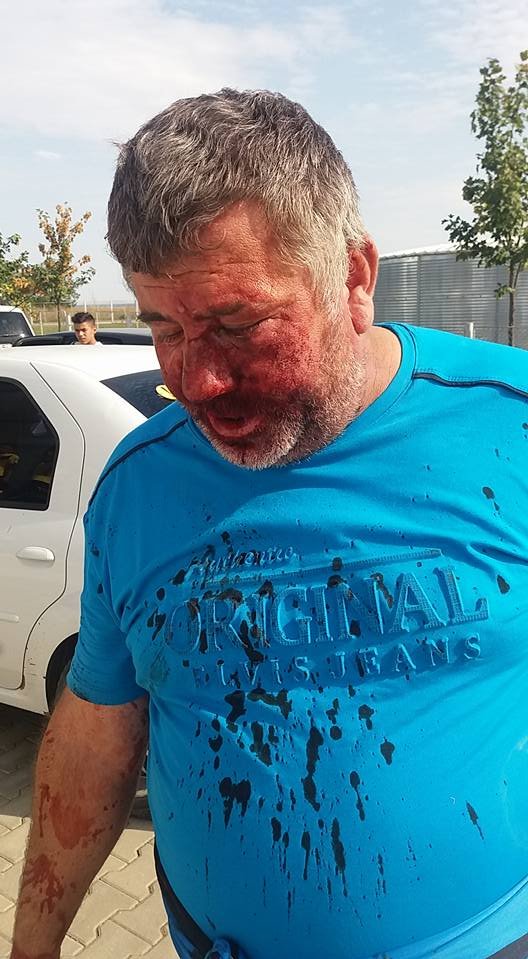 Un antrenor din Liga a IV-a Giurgiu a fost umplut de sânge de rudele unui fotbalist. Imagini șocante - FOTO