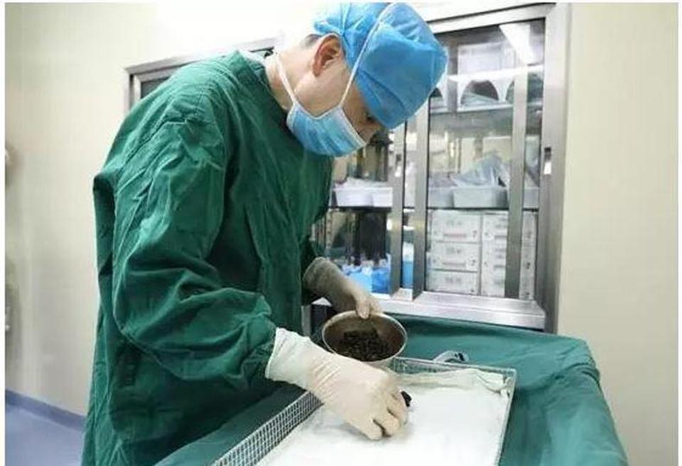 Timp de opt ani a sărit peste micul dejun. Când femeia a ajuns la spital cu dureri cumplite de stomac, medicii au dus-o imediat în sala de operație. Este cumplit ce au găsit în burta femeii (FOTO) 489186