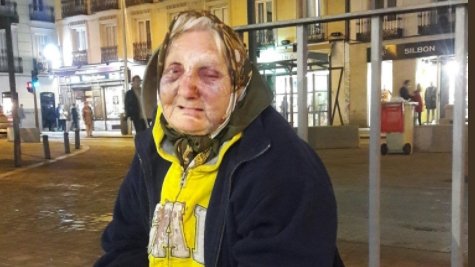 O româncă a fost desfigurată în urma unui atac rasist, la Madrid