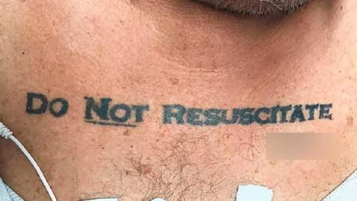 Un bărbat de 70 de ani a ajuns de urgență la spital în stare inconștientă. Când medicii i-au desfăcut cămașa, au avut un șoc. Habar nu aveau ce trebuiau să facă (FOTO) 494886