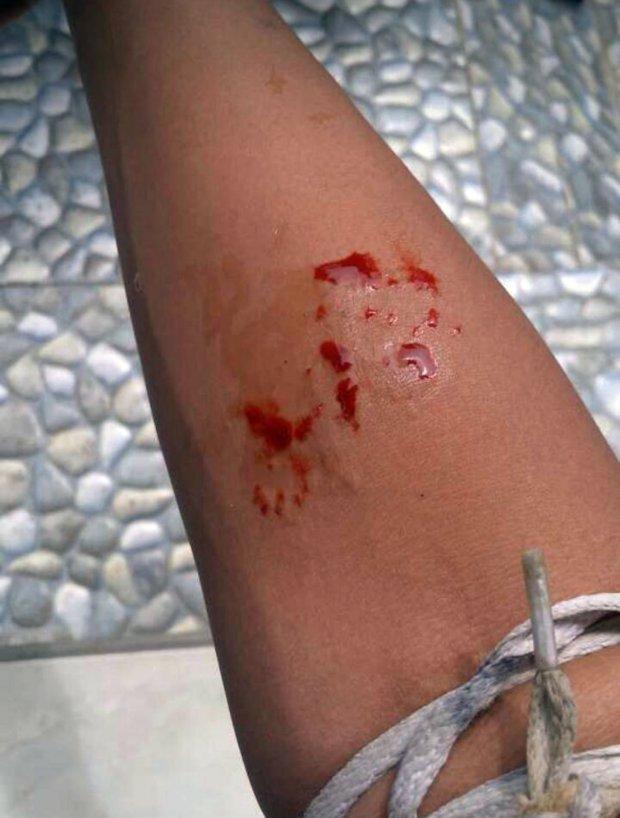 A postat aceste imagini pe rețelele de socializare, apoi la scurt timp a murit. Ce s-a întâmplat 498169