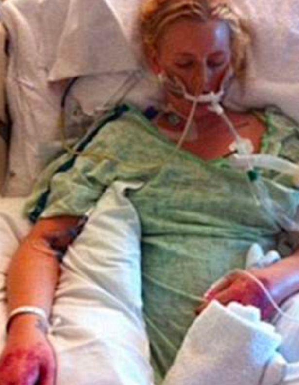 Și-a pierdut piciorul din cauza unui produs pentru igiena intimă. Acum îl va pierde și pe celălalt - IMAGINI ȘOCANTE 498250